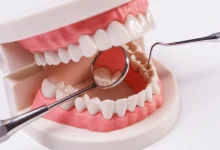 finding-the-best-dentists-in-sydney:-what-to-look-for