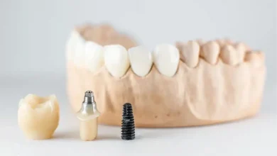 what-makes-tooth-implants-look-and-feel-natural?